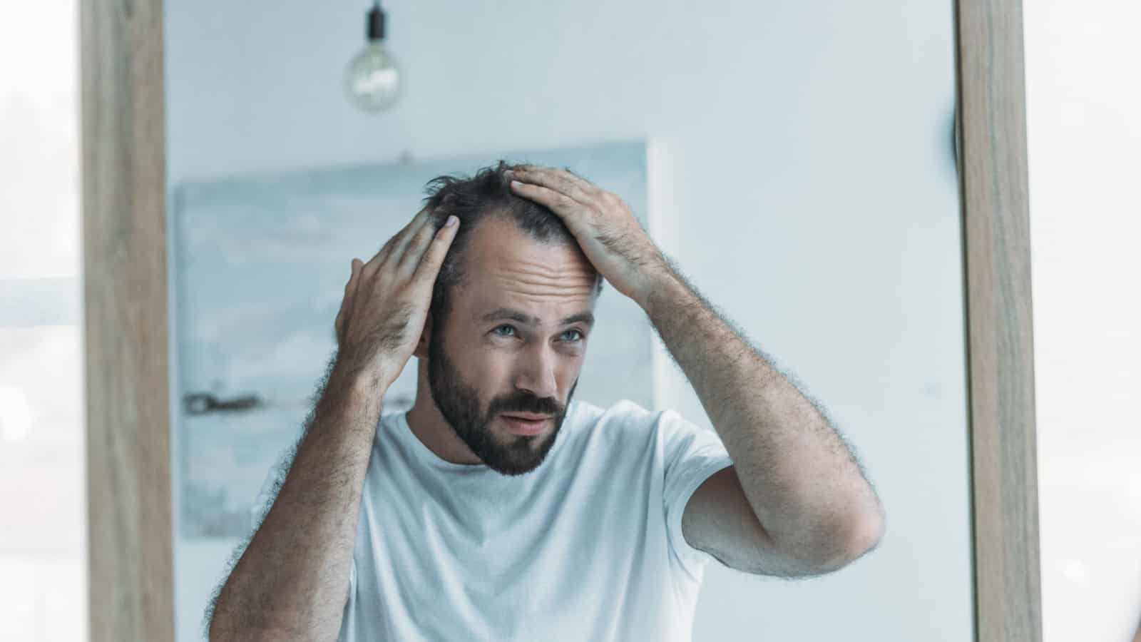 balding, hair loss, embarrassing, insecurity